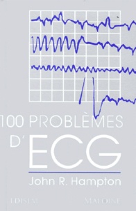Artinborgo.it 100 PROBLEMES D'ECG Image