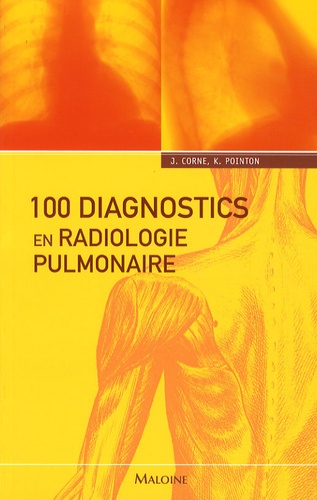 Jonathan Corne et Kate Pointon - 100 diagnostics en radiologie pulmonaire.