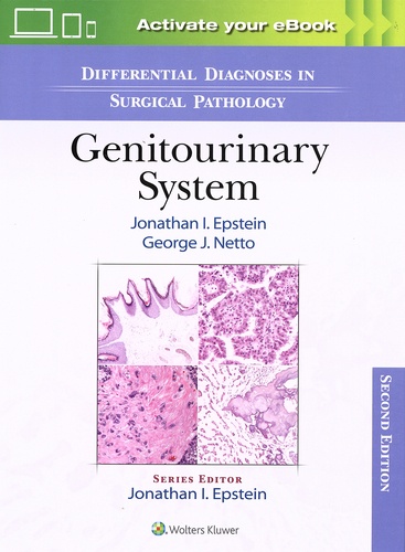 Jonathan Epstein et George Netto - Differential Diagnoses in Surgical Pathology: Genitourinary System.
