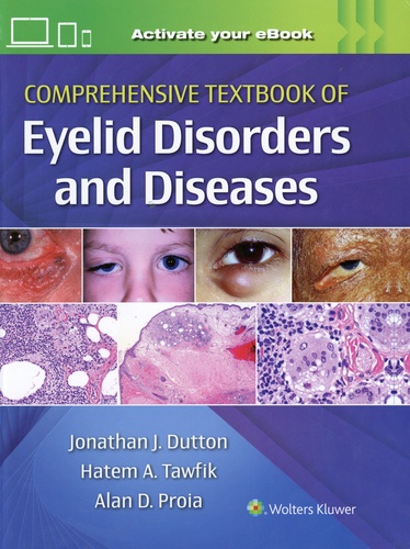 Jonathan J. Dutton et Hatem A. Tawfik - Comprehensive Textbook of Eyelid Disorders and Diseases.