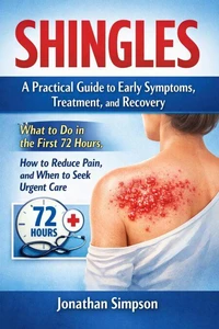 Shingles A Practical Guide to Early Symptoms Treatment and Recovery