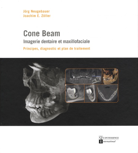 Jörg Neugebauer et Joachim Zöller - Cone Beam : imagerie dentaire et maxillofaciale - Principes, diagnostic et plan de traitement.