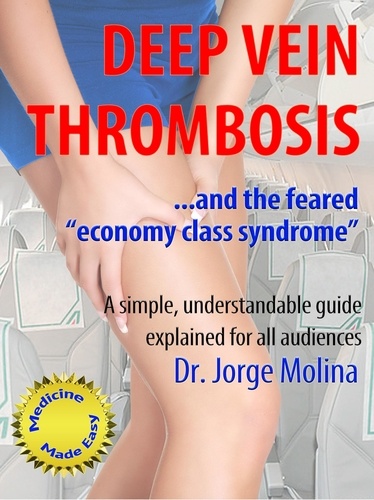  Jorge Molina - Deep Vein Thrombosis - La Medicina hecha fácil - Medicine Made Easy, #4.