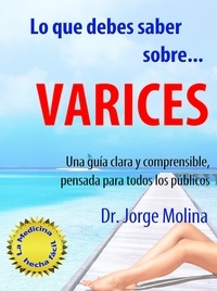  Jorge Molina - Lo que debes saber sobre... Varices - La Medicina hecha fácil - Medicine Made Easy, #1.
