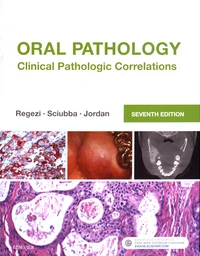 Oral Pathology