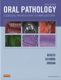Oral Pathology