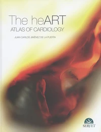 The heART