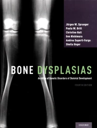 Bone Dysplasias