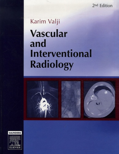 Karim Valji - Vascular and Interventional Radiology.