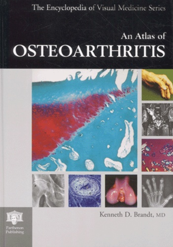 Kenneth-D Brandt - An Atlas Of Osteoarthritis.