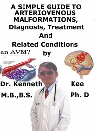 A  Simple  Guide  to  Arteriovenous Malformations,  Diagnosis, Treatment  and  Related Conditions