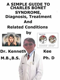 A  Simple  Guide  to  Charles Bonnet Syndrome,  Diagnosis, Treatment  and  Related Conditions
