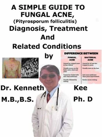 A  Simple  Guide  to  Fungal Acne, (Pityrosporum folliculitis)  Diagnosis, Treatment  and  Related Conditions