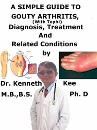 A  Simple  Guide  to  Gouty Arthritis (With Tophi),  Diagnosis, Treatment  and  Related Conditions