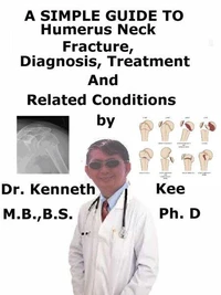 A  Simple  Guide to  Humerus Neck Fracture, (As narrated by A Patient), Diagnosis, Treatment and  Related Conditions