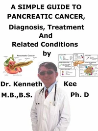 A  Simple  Guide  to  Pancreatic Cancer,  Diagnosis, Treatment and  Related Conditions