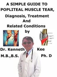 A  Simple  Guide  to  Popliteal Muscle Tear,  Diagnosis, Treatment  and  Related Conditions