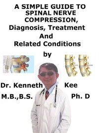 A  Simple  Guide  to  Spinal Nerve Compression,  Diagnosis, Treatment  and  Related Conditions