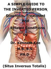 A  Simple  Guide  To  The Inverted Person, (Situs Inversus)  Diagnosis, Treatment  And  Related Conditions