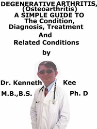 Degenerative Arthritis (Osteoarthritis)  A  Simple  Guide  To  The Condition, Diagnosis, Treatment  And  Related Conditions