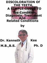 Discoloration of  The Teeth,  A  Simple  Guide  To  The Condition, Diagnosis, Treatment  And  Related Conditions