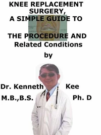 Knee Replacement  Surgery,  A  Simple  Guide  To  The Procedure  And  Related Conditions