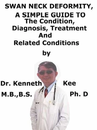 Swan Neck Deformity,  A  Simple  Guide  To  The Condition, Diagnosis, Treatment  And  Related Conditions