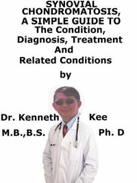 Synovial Chondromatosis,  A  Simple  Guide  To  The Condition, Diagnosis, Treatment  And  Related Conditions