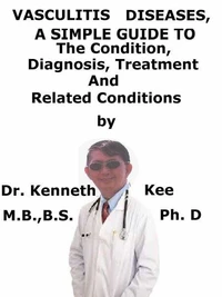 Vasculitis Diseases,  A  Simple  Guide  To  The Condition, Diagnosis, Treatment  And  Related Conditions