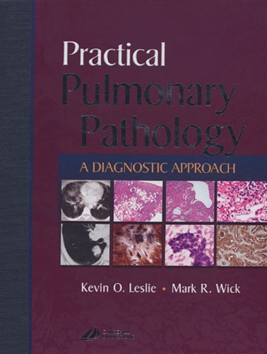Kevin O Leslie - Practical Pulmonary Pathology - A Diagnostic Approach. 1 Cédérom