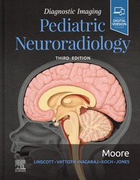 Kevin-R Moore et Luke L Linscott - Diagnostic Imaging Pediatric Neuroradiology.