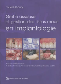 Greffe osseuse et gestion des tissus mous en implantologie