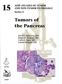 Tumors of the Pancreas