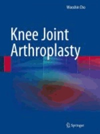 Knee Joint Arthroplasty.