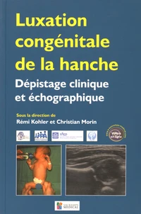 Luxation congénitale de la hanche