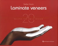 Laminate Veneers