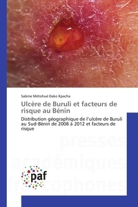 Kpacha sabine mètohué Dako - Ulcère de Buruli et facteurs de risque au Bénin - Distribution géographique de l'ulcère de Buruli au Sud-Bénin de 2008 à 2012 et facteurs de risque.