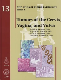 Tumors of the Cervix, Vagina, and Vulva