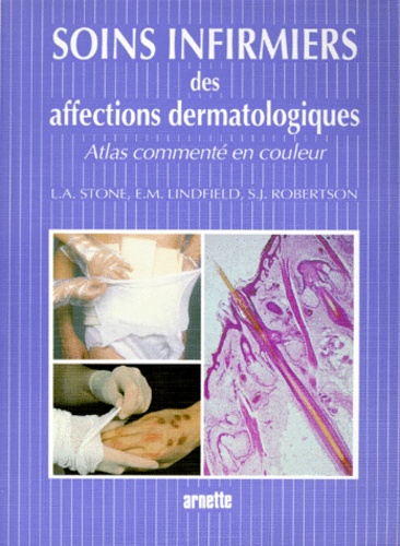 L-A Stone et S-J Robertson - Soins Infirmiers Des Affections Dermatologiques. Atlas Commente En Couleur.