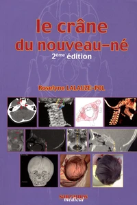 Le crâne du nouveau-né