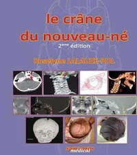 Le crâne du nouveau-né