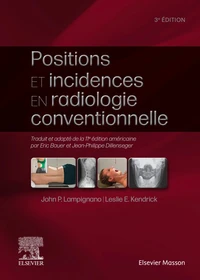 Positions et incidences en radiologie conventionnelle