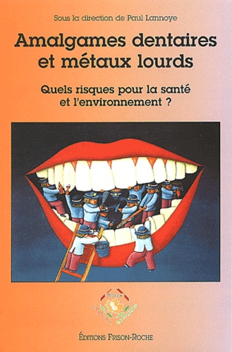 LANNOYE P. - Amalgames Dentaires Et Metaux Lourds. Quels Risques Pour La Sante Et L'Environnement ?.