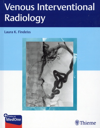 Venous Interventional Radiology