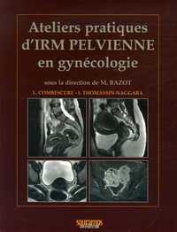 Laurent Combescure et Isabelle Thomassin-Naggara - Ateliers pratiques d'IRM pelvienne en gynécologie.