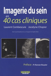 Laurent Combescure et Jocelyne Chopier - Imagerie du sein en 40 cas cliniques.