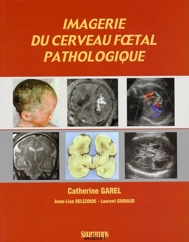 Laurent Guibaud et Catherine Garel - Imagerie Du Cerveau Foetal Pathologique.