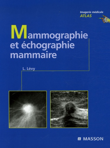 Laurent Lévy - Mammographie et échographie mammaire.