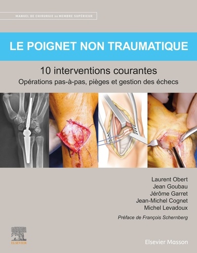 Le poignet non traumatique : 10 interventions courantes. Manuel de chirurgie du membre supérieur