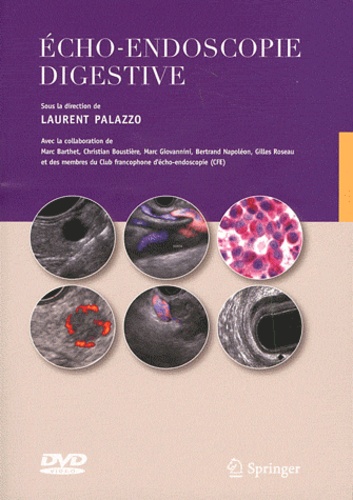 Laurent Palazzo - Echo-endoscopie digestive. 1 DVD